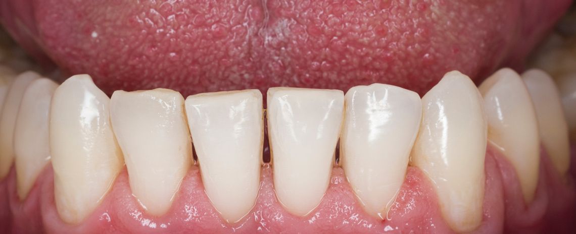 Hygiene Clean After